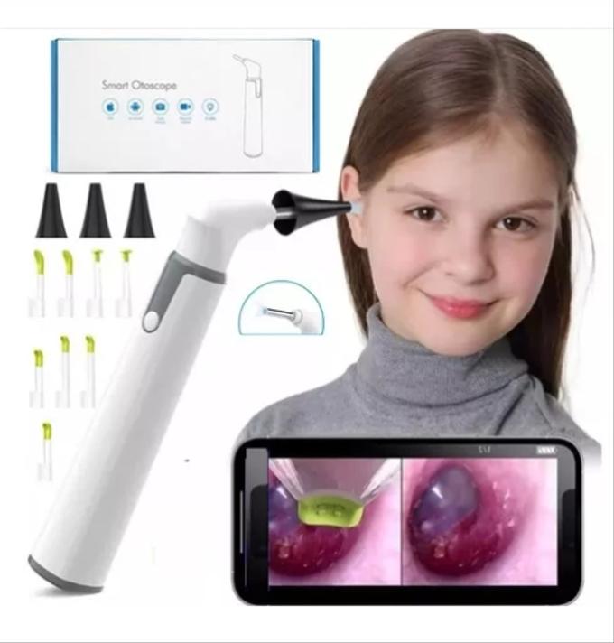 Otoscope Otoscope smart led