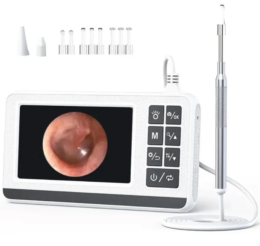 Kanoscope, otoscope numérique